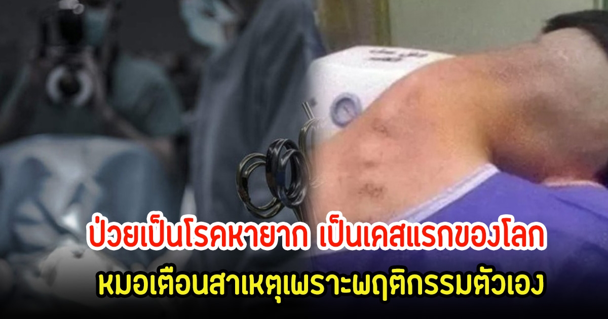 ช็อก! หนุ่มวัย 23 ป่วยเป็นโรคหายาก เป็นเคสแรกของโลก หมอเตือนสาเหตุเพราะพฤติกรรมตัวเอง