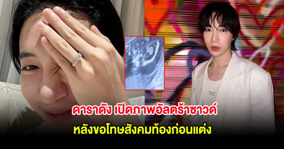 ชัดเจน ดาราดัง เปิดภาพอัลตร้าซาวด์ หลังขอโทษสังคมท้องก่อนแต่ง