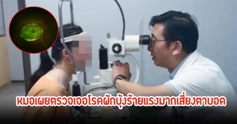 สาววัย 38 ปี รู้สึกมองอะไรไม่ชัด รู้สาเหตุช็อก หมอเผยตรวจเจอโรคผักบุ้งร้ายแรงมากเสี่ยงตาบอด