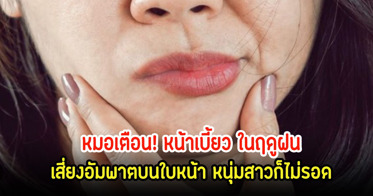 หมอเตือน! หน้าเบี้ยว ในฤดูฝน เสี่ยงอัมพาตบนใบหน้า หนุ่มสาวก็ไม่รอด