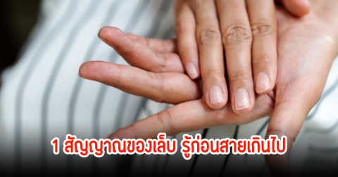 เทรนเนอร์เผย 1 สัญญาณของเล็บ รู้ก่อนสายเกินไป ช็อกตรวจพบเป็นมะเร็ง