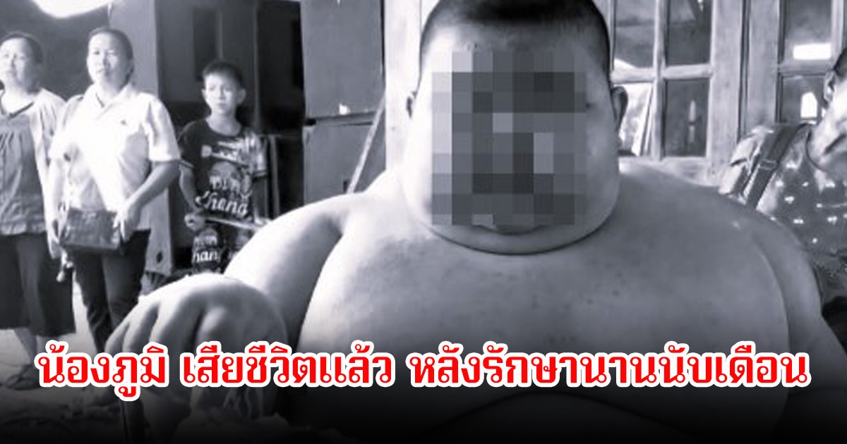 อาลัย น้องภูมิ วัย 11 ขวบ หนัก 150 กก. เสียชีวิตแล้ว หลังรักษานานนับเดือน