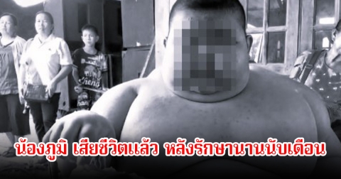 อาลัย น้องภูมิ วัย 11 ขวบ หนัก 150 กก. เสียชีวิตแล้ว หลังรักษานานนับเดือน