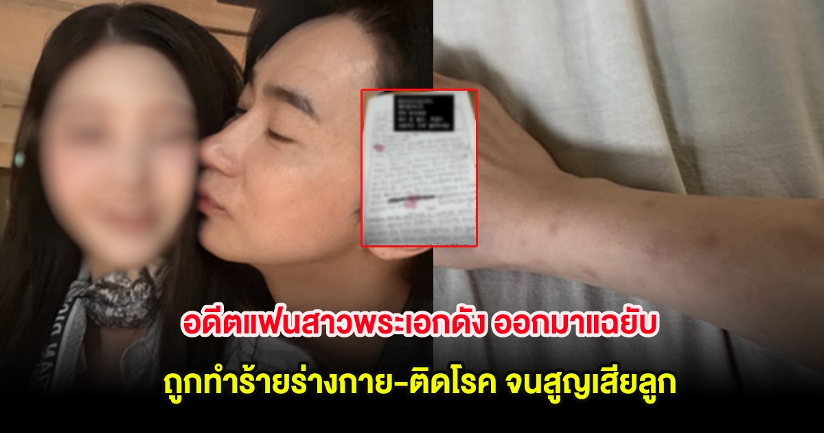 อดีตแฟนสาวพระเอกดัง ออกมาแฉยับ ถูกทำร้ายร่างกาย-ติดโรค จนสูญเสียลูก (ต่างประเทศ)