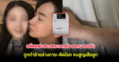 อดีตแฟนสาวพระเอกดัง ออกมาแฉยับ ถูกทำร้ายร่างกาย-ติดโรค จนสูญเสียลูก (ต่างประเทศ)