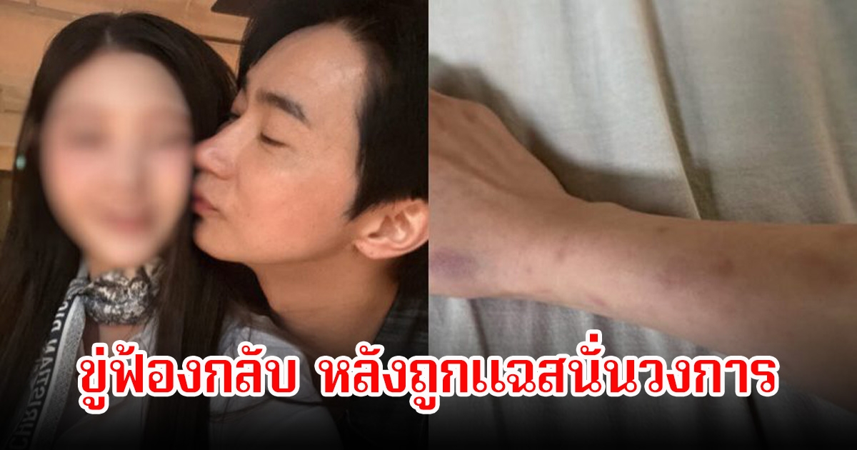 ไม่ทน! นักแสดงหนุ่ม ขู่ฟ้อง หลังอดีตแฟนสาวออกมาแฉยับ ถูกทำร้ายร่างกาย-ติดโรค (ข่าวต่างประเทศ)