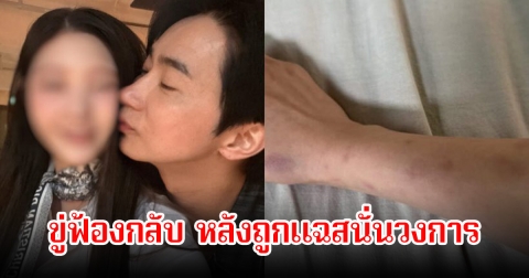 ไม่ทน! นักแสดงหนุ่ม ขู่ฟ้อง หลังอดีตแฟนสาวออกมาแฉยับ ถูกทำร้ายร่างกาย-ติดโรค (ข่าวต่างประเทศ)