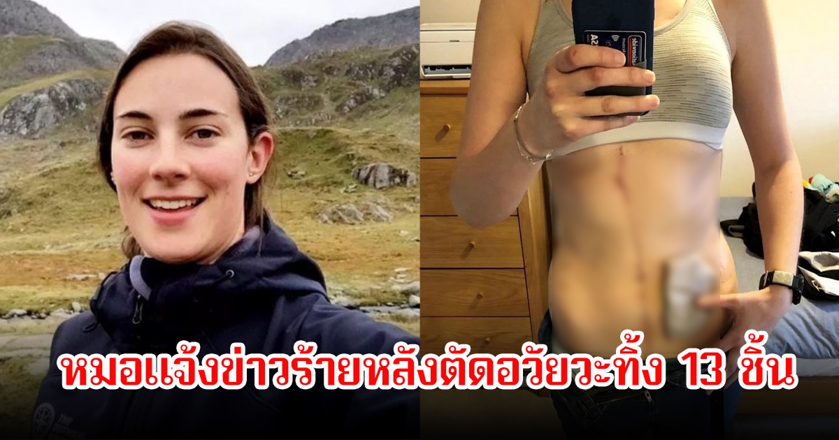 ช็อก! สาวรายหนึ่ง ป่วยโรคเดียวกันกับนักแสดงที่เสียชีวิตไปแล้ว  หมอแจ้งข่าวร้าย หลังตัดอวัยวะทิ้ง 13 ชิ้น