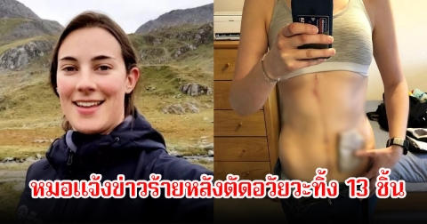 ช็อก! สาวรายหนึ่ง ป่วยโรคเดียวกันกับนักแสดงที่เสียชีวิตไปแล้ว  หมอแจ้งข่าวร้าย หลังตัดอวัยวะทิ้ง 13 ชิ้น