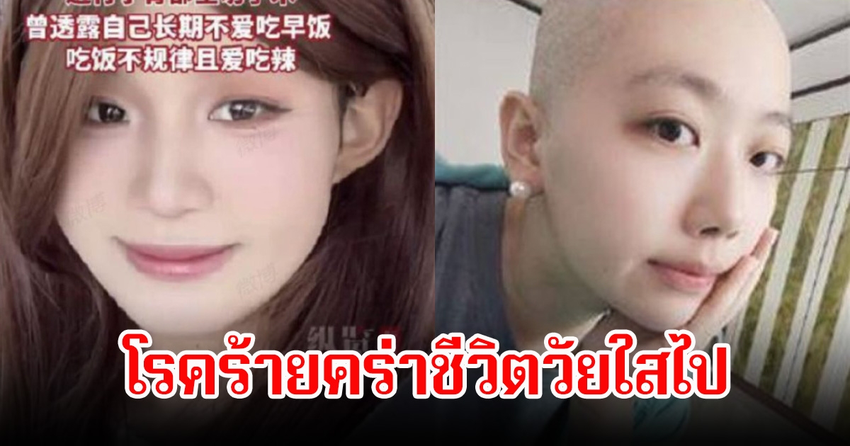 แฟนๆช็อก ไอดอลสาว เสียชีวิตในวัย 25 ปี หมอรีบเตือน 4 สัญญาณโรคร้าย