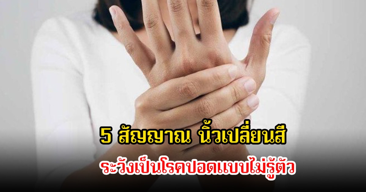 แพทย์เตือน! 5 สัญญาณ นิ้วเปลี่ยนสี ปวดมือโดยไม่ทราบสาเหตุ ระวังเป็นโรคปอดแบบไม่รู้ตัว