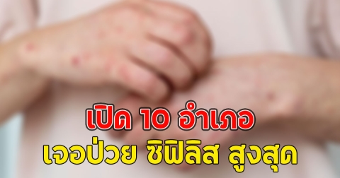 แย่แล้ว!! เปิด 10 อำเภอเจอป่วย ซิฟิลิส สูงสุด