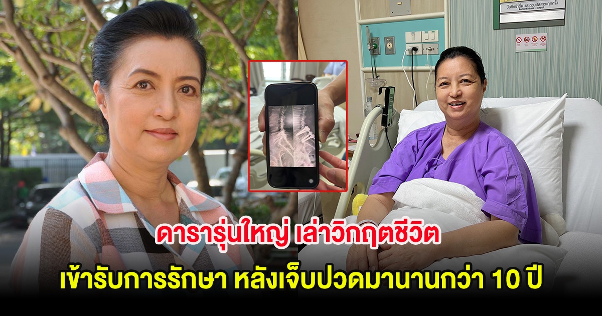 ส่งกำลังใจ ดารารุ่นใหญ่ เล่าวิกฤตชีวิต เข้ารับการรักษา หลังเจ็บปวดมานานกว่า 10 ปี