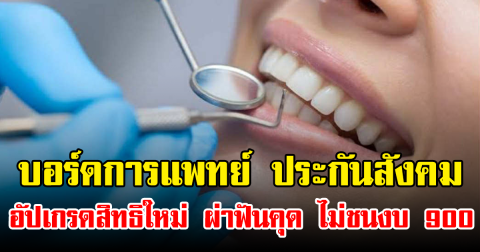 บอร์ดการแพทย์ ประกันสังคมอัปเกรดสิทธิใหม่ ผ่าฟันคุด ไม่ชนงบ 900