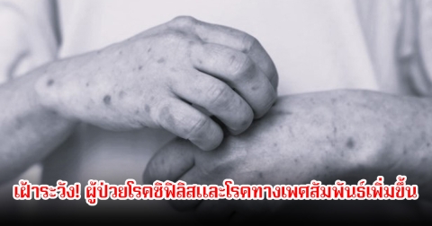 เฝ้าระวัง! ผู้ป่วยโรคซิฟิลิสและโรคทางเพศสัมพันธ์เพิ่มขึ้น