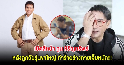 เปิดสีหน้า ทูน หิรัญทรัพย์ หลังถูกวัยรุ่นขาใหญ่ ทำร้ายร่างกายเจ็บหนัก!!