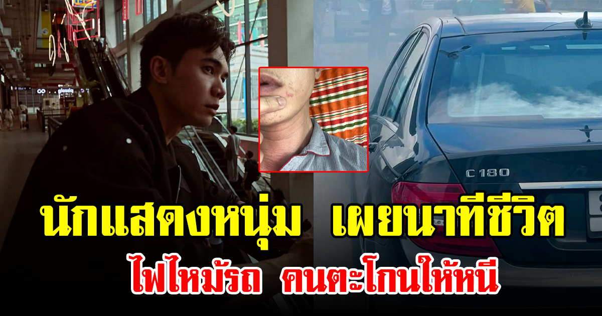 นักแสดงหนุ่ม เผยนาทีชีวิต ไฟไหม้รถ คนตะโกนให้หนี