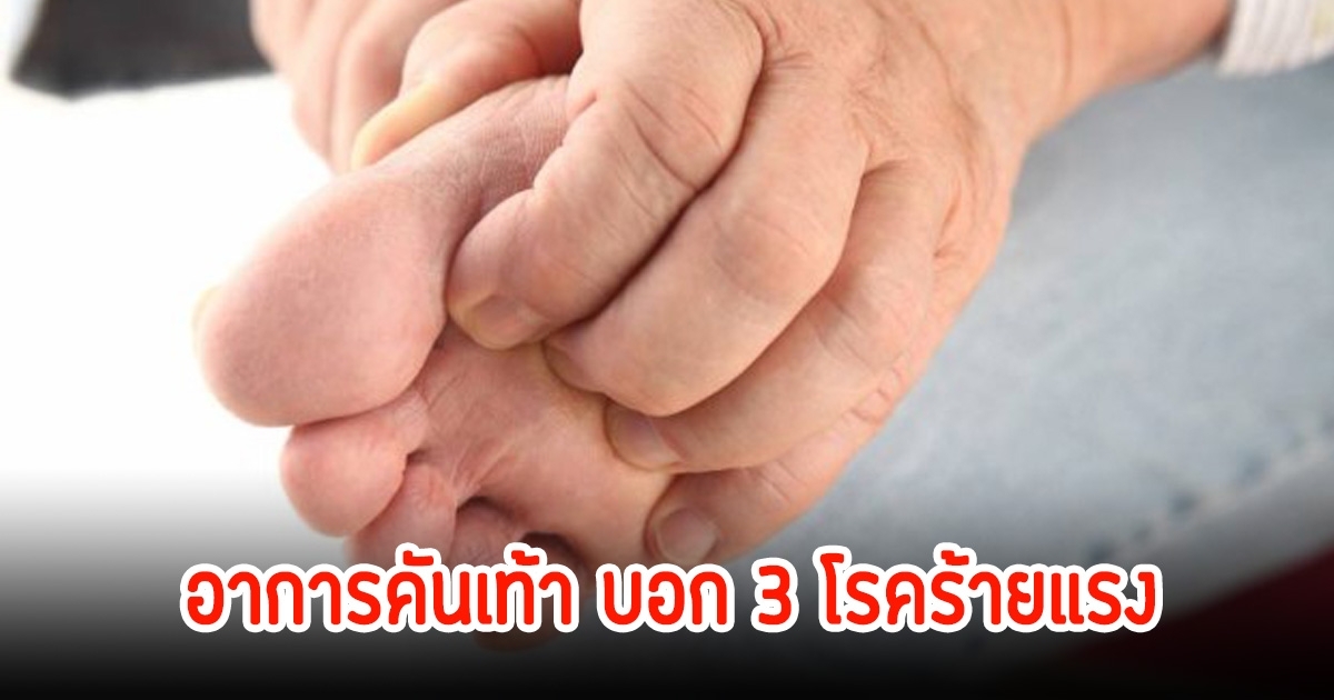 เตือนสัญญาณ! อาการคันเท้า บอก 3 โรคร้าย อย่าชะล่าใจ