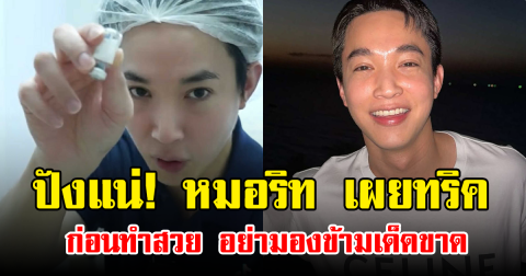 ปังแน่! หมอริท เผยทริคก่อนทำสวย อย่ามองข้ามเด็ดขาด
