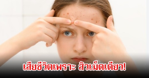 อันตรายมาก! สาววัย 15 ปี เสียชีวิตเพราะ สิวเม็ดเดียว หมอเตือนนิสัยที่หลายคนยังทำ