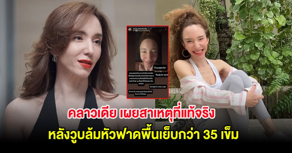 คลาวเดีย จักรพันธุ์ เผยสาเหตุที่แท้จริง หลังวูบล้มหัวฟาดพื้นเย็บกว่า 35 เข็ม