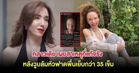 คลาวเดีย จักรพันธุ์ เผยสาเหตุที่แท้จริง หลังวูบล้มหัวฟาดพื้นเย็บกว่า 35 เข็ม