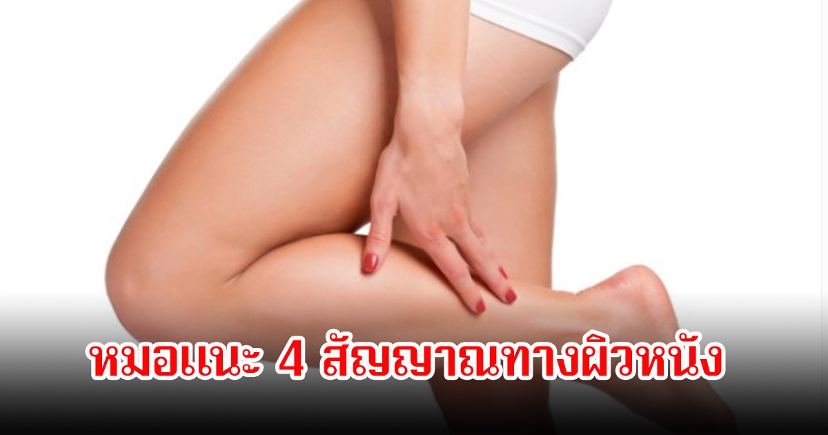 เตือน! คันที่ขา 2 เดือน ที่แท้เป็นมะเร็ง หมอแนะ 4 สัญญาณทางผิวหนัง