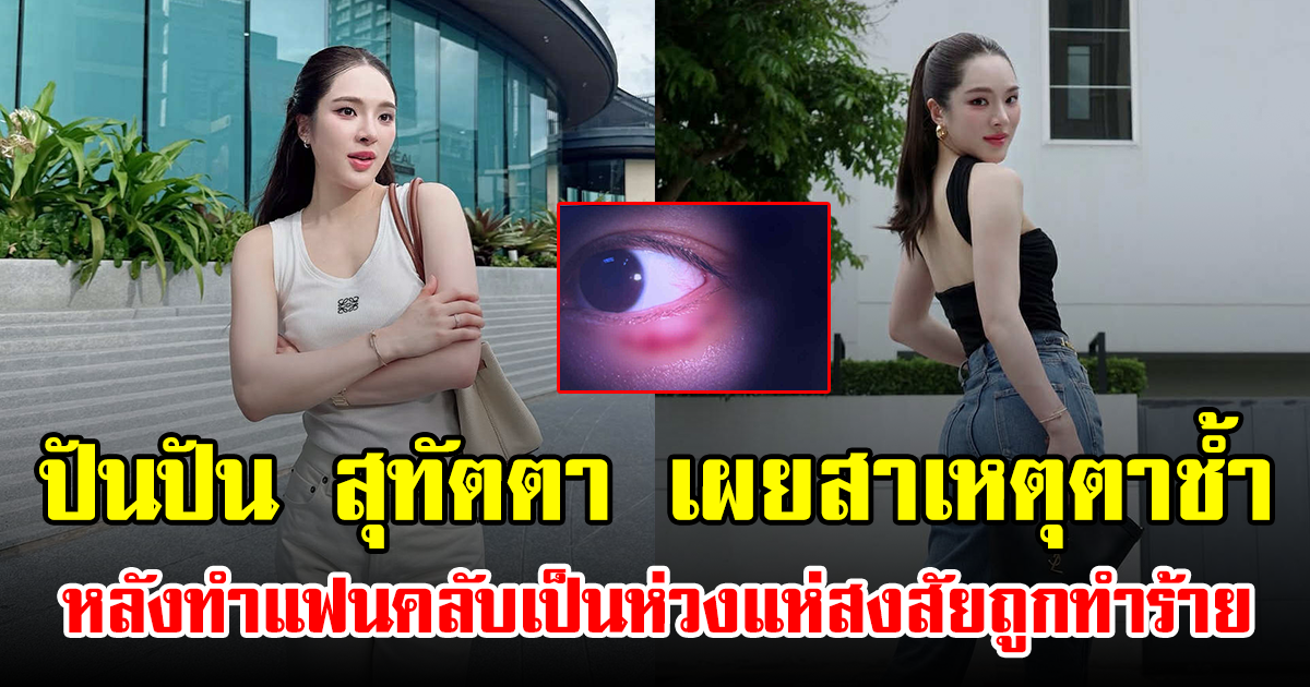ปันปัน สุทัตตา เผยสาเหตุตาช้ำ หลังทำแฟนคลับเป็นห่วงแห่สงสัยถูกทำร้าย