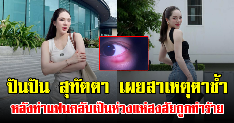 ปันปัน สุทัตตา เผยสาเหตุตาช้ำ หลังทำแฟนคลับเป็นห่วงแห่สงสัยถูกทำร้าย