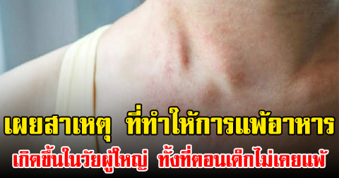 เผยสาเหตุ ที่ทำให้การแพ้อาหารเกิดขึ้นในวัยผู้ใหญ่ ทั้งที่ตอนเด็กไม่เคยแพ้