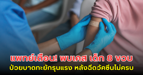แพทย์เตือน! พบเคส เด็ก 8 ขวบป่วยบาดทะยักรุนแรง หลังฉีดวัคซีนไม่ครบ