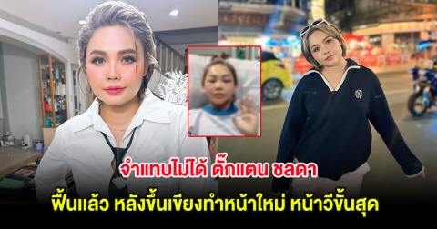 จำแทบไม่ได้ ตั๊กแตน ชลดา ฟื้นเเล้ว หลังขึ้นเขียงทำหน้าใหม่ หน้าวีขั้นสุด