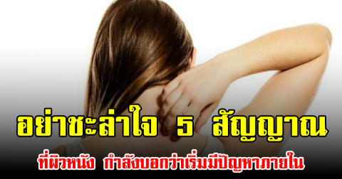อย่าชะล่าใจ 5 สัญญาณ ที่ผิวหนัง กำลังบอกว่าเริ่มมีปัญหาภายใน