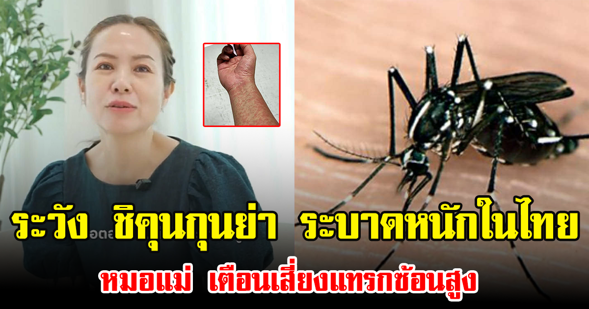 ระวัง ชิคุนกุนย่า ระบาดหนักในไทย หมอแม่ เตือนเสี่ยงแทรกซ้อนสูง