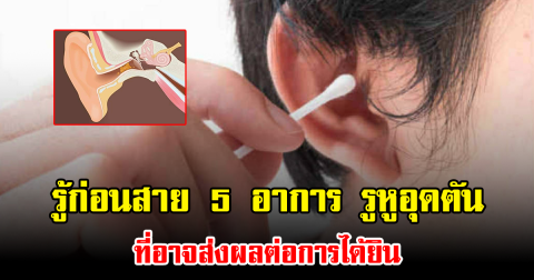 รู้ก่อนสาย 5 อาการ รูหูอุดตันที่อาจส่งผลต่อการได้ยิน