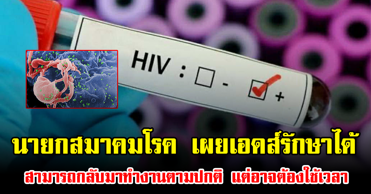 นายกสมาคมโรค เผยเอดส์รักษาได้ สามารถกลับมาทำงานตามปกติ แต่อาจต้องใช้เวลา