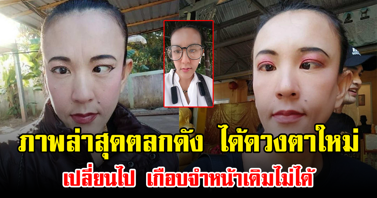 ภาพล่าสุดตลกดัง ได้ดวงตาใหม่ เปลี่ยนไป เกือบจำหน้าเดิมไม่ได้