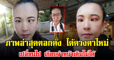 ภาพล่าสุดตลกดัง ได้ดวงตาใหม่ เปลี่ยนไป เกือบจำหน้าเดิมไม่ได้