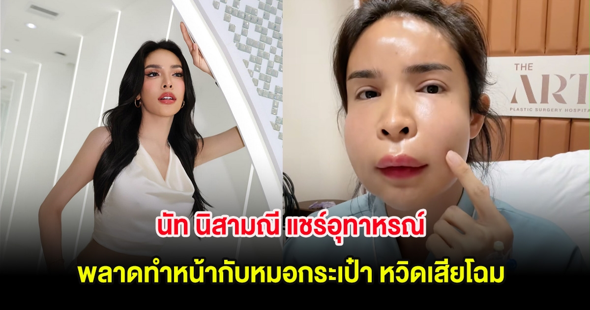นัท นิสามณี แชร์อุทาหรณ์ คนรักสวยรักงาม พลาดทำหน้ากับหมอกระเป๋า หวิดเสียโฉม