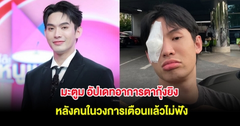 มะตูม อัปเดทอาการตากุ้งยิง หลังคนในวงการเตือนเเล้วไม่ฟัง