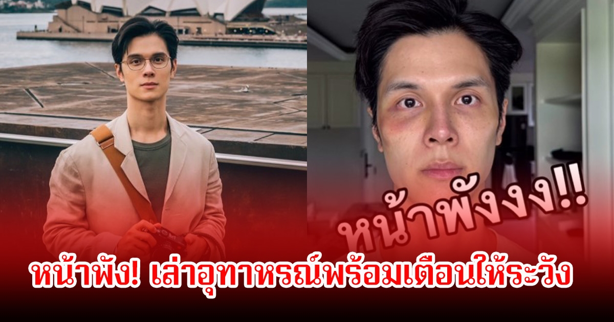 หน้าพัง! โยชิ นิมิต เล่าอุทาหรณ์พร้อมเตือนให้ระวัง ทั้งเสียเงินทั้งเจ็บตัว