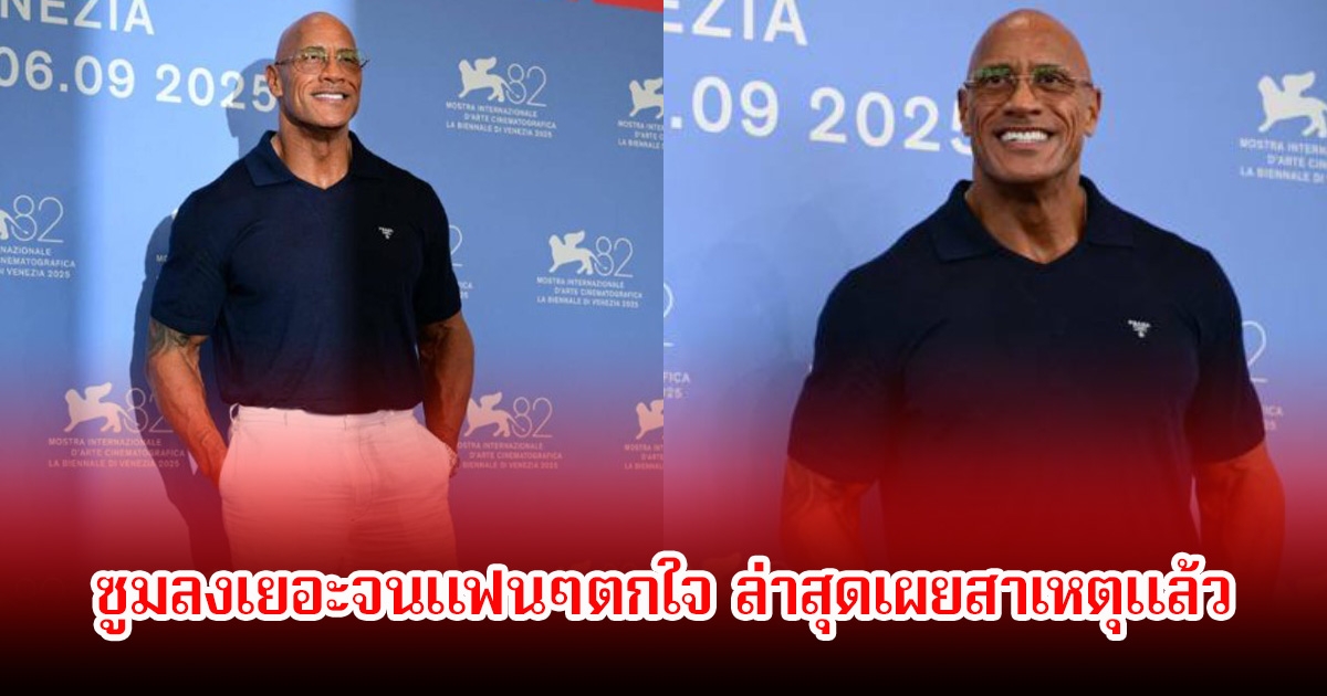 สุดห่วง! นักแสดงชื่อดัง ซูมลงเยอะจนแฟนๆตกใจ ล่าสุดเผยสาเหตุแล้ว (ข่าวต่างประเทศ)