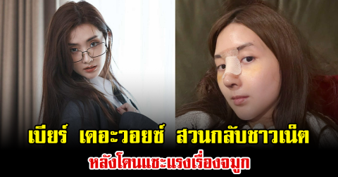เบียร์ เดอะวอยซ์ สวนกลับชาวเน็ต หลังโดนแซะแรงเรื่องจมูก