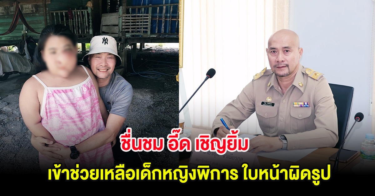 ชื่นชม อี๊ด เชิญยิ้ม เข้าช่วยเหลือเด็กหญิงพิการ ใบหน้าผิดรูป