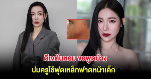 ดีเจต้นหอม ขอพูดบ้าง ปมครูใช้ฟุตเหล็กฟาดหน้าเด็ก หลังเคยลงไปแล้ว สุดท้ายนิ่งหมด