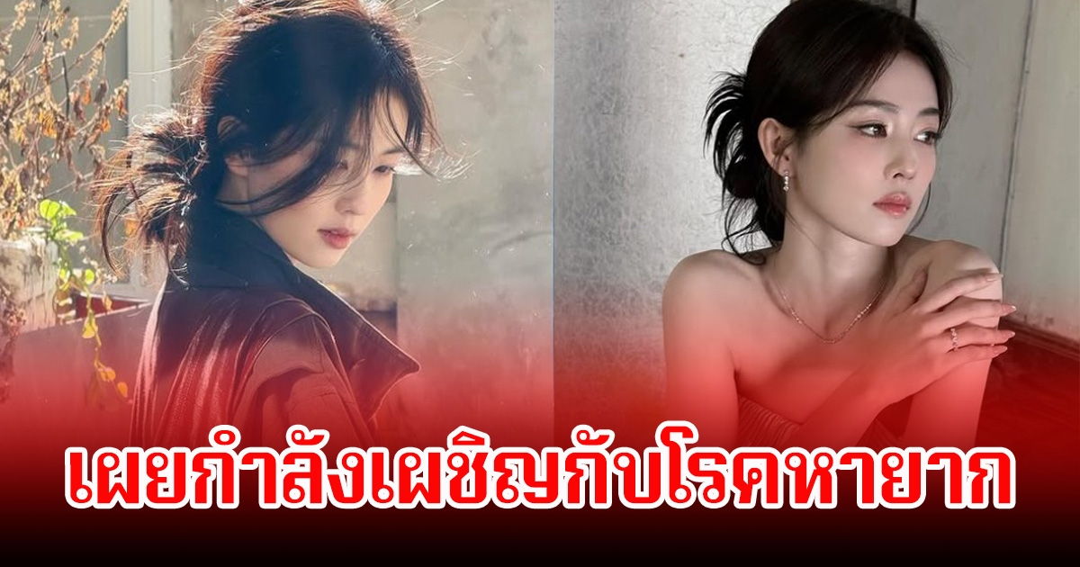 นางเอกดัง เผยกำลังเผชิญกับโรคหายาก อาการแย่ต้องทุกข์ทรมาน (ข่าวต่างประเทศ)