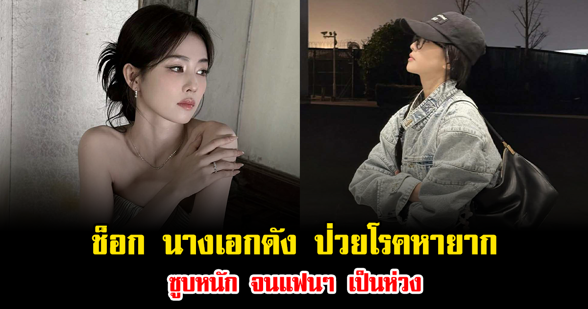 ช็อก นางเอกดัง ป่วยโรคหายาก ซูบหนัก จนแฟนๆ เป็นห่วง (ข่าวต่างประเทศ)