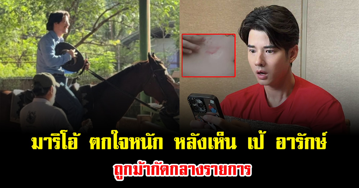 มาริโอ้ ตกใจหนัก หลังเห็น เป้ อารักษ์ ถูกม้ากัดกลางรายการ จนรอยช้ำชัดเจน