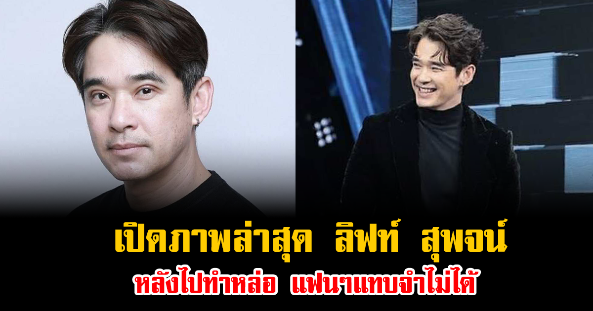 เปิดภาพล่าสุด ลิฟท์ สุพจน์ หลังไปทำหล่อ แฟนๆแทบจำไม่ได้