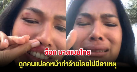 ช็อก นางแบบไทย ถูกคนแปลกหน้าทำร้ายโดยไม่มีสาเหตุ ขณะเดินอยู่ LA